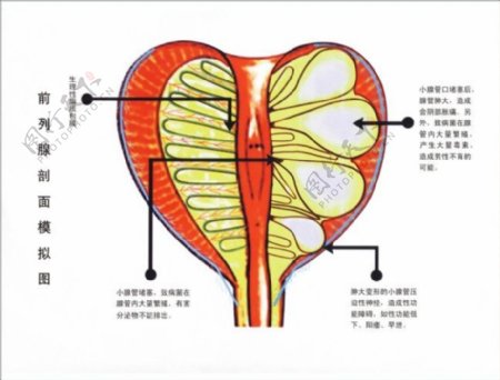 医院展板男科女前列腺剖面模拟图