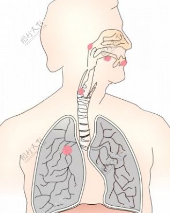 肺癌的矢量图像符号
