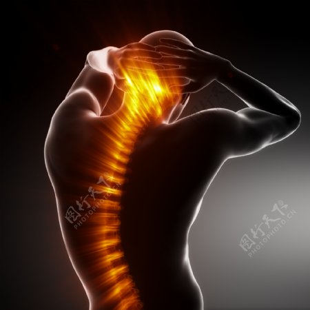 脊椎头痛图片