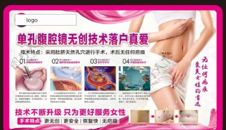 单孔腹腔镜妇科广告