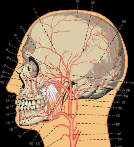 脑血管图颈外动脉图片
