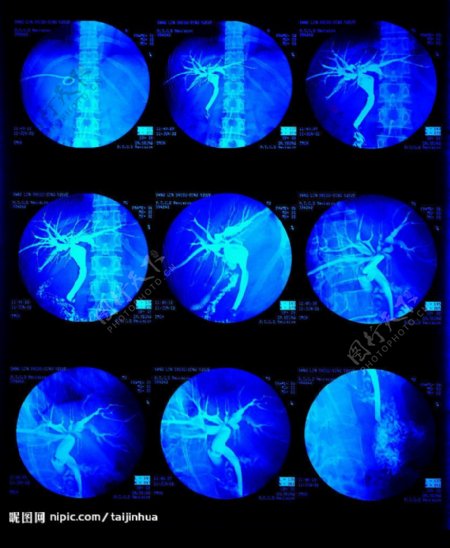 X光照片医疗科技卫生工作图片