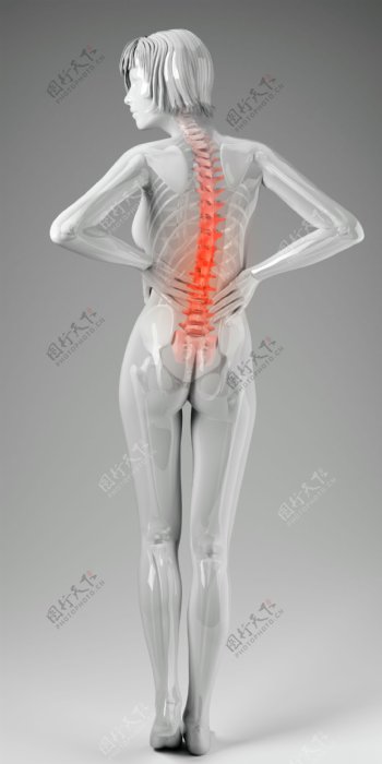 女性脊椎X光图像图片