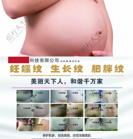 妊娠纹海报图片